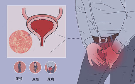 南京家和医院男科-泌尿生殖感染